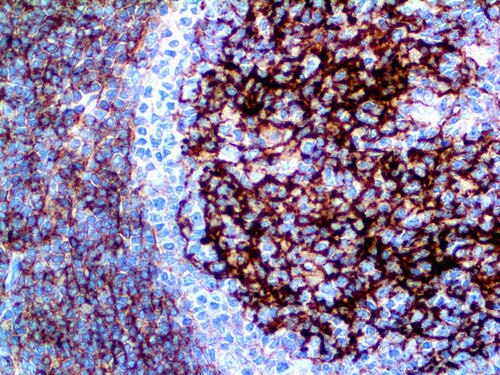 IHC of CD23 on an FFPE Tonsil Tissue